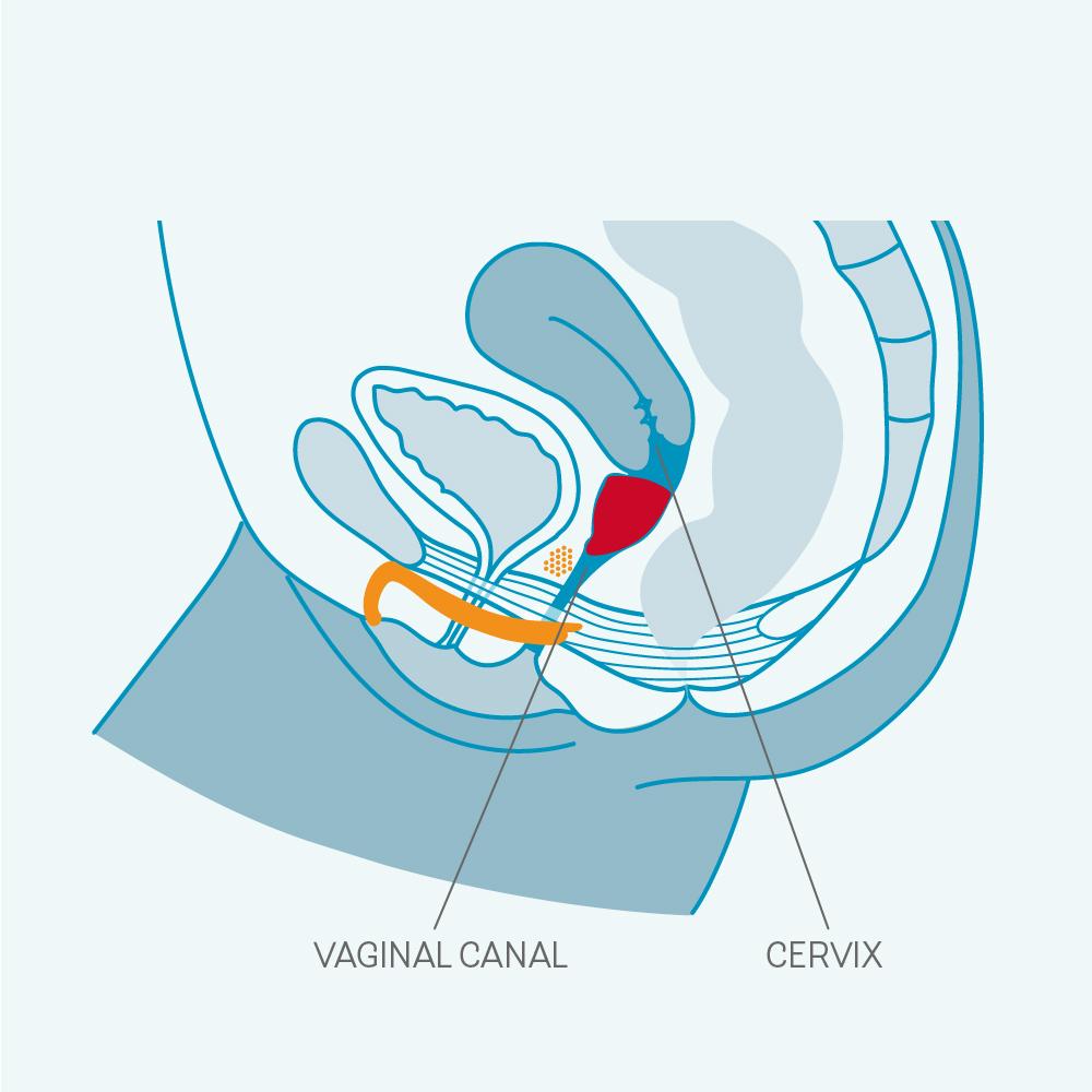 An Anatomical Diagram showing the Fun Cup Usage.
